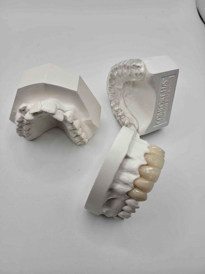 dental molds