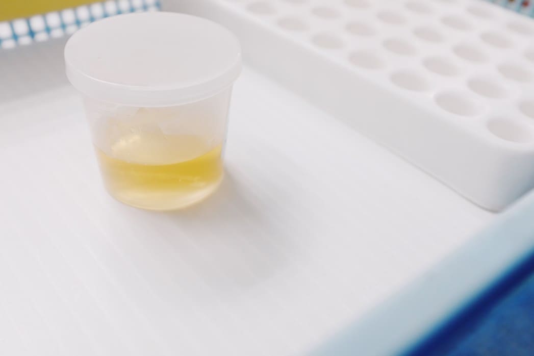 pee in a pill bottle